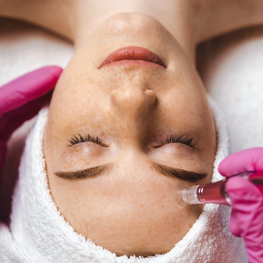Frau, die sich einer Mikrodermabrasion im Gesicht zur Behandlung von Akne unterzieht. Professionelles Kosmetikstudio. Hautbehandlung. Kosmetisches Wellness-Studio. Gesundheitspflege, Schönheitsbehandlung.